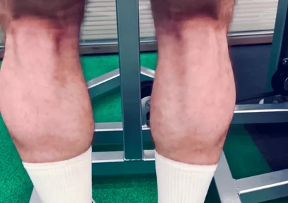 My Legs