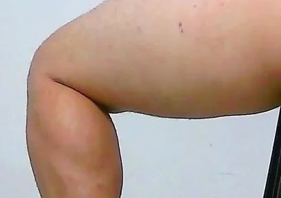 Oh, My Ass Hurts, Apply Ointment