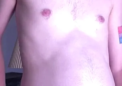 Young Mans Belly Turns Into a Orb