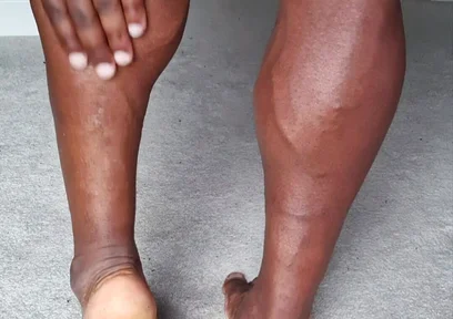 For My Feet Lovers