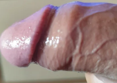 Strange Lumpy Cock with a Gigantic Head.