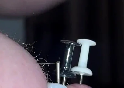 Thumtacks hurt
