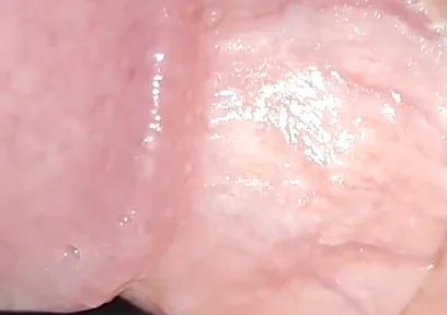 Incredible Cock, Unique of Slippery Phimosis by the Robust Body.