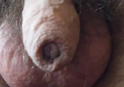 My Penis Walkabout