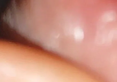 Hot Daddy in Close-up of the Inside of the Glans!