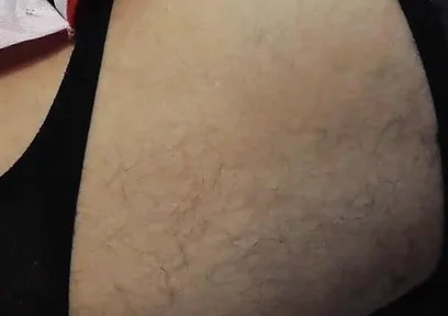 Rot Couch