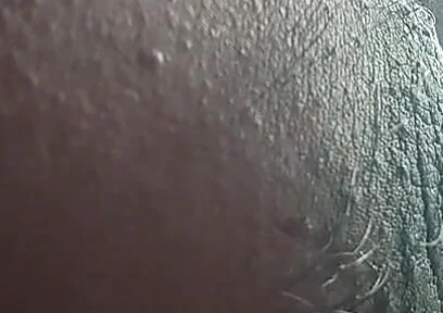 Armpit