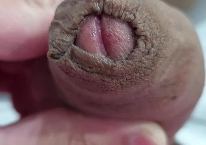 The Head of My Penis