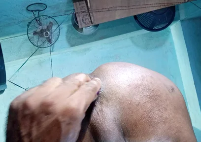 Anal sex