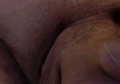 Limping Dick