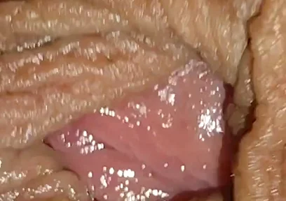 Boy with Large Anal Phimosis Excited!