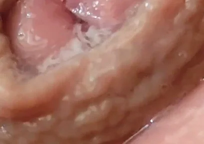 Juice From the Glans When Excited to the Extreme.