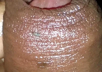Close-up of Foreskin and Ejaculation in My Pants