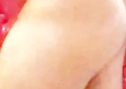 Whip-lash