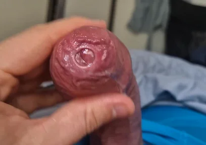 Phimosis Cock Precum Drip Close-up
