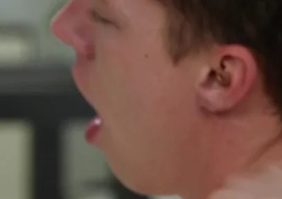Exposed