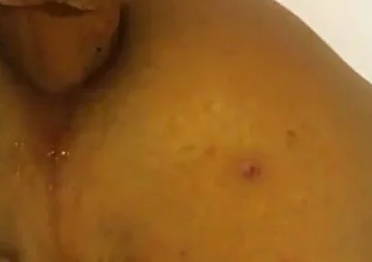 Deep in the Butt