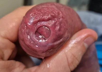 Uncut Head Precum Play