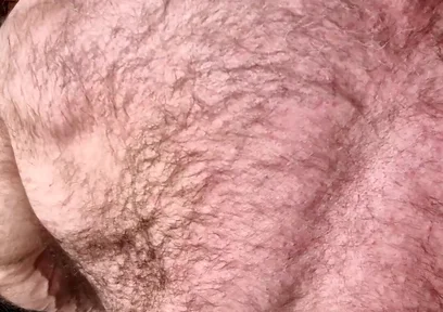 Hairy Muscle Back