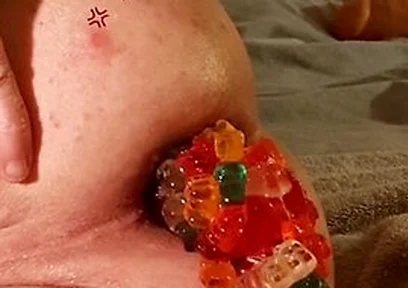 Big Load Of Gummy Bears Anal Stuffing And Expulsion Whit Prolapse