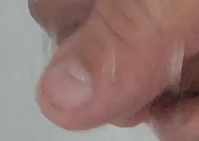 Strong Water in the Foreskin Excites the Glans Precum.