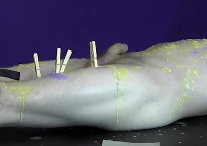 Pinching pegs leave welts