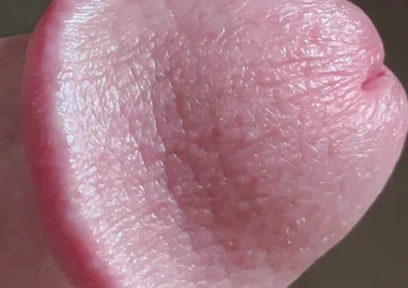 Closeup of Penis with One Vein