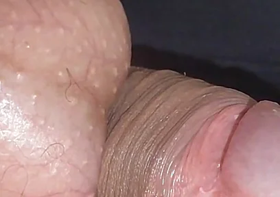 Amazing Upright Rough Venous Frenulum.