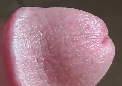 Closeup of Penis with One Vein