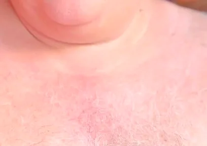 Old Man with Thickest Mushroom Penis