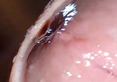 Glans Eye Watering After Intense Fucking.