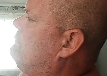 Renewed Destruction of the Bitch