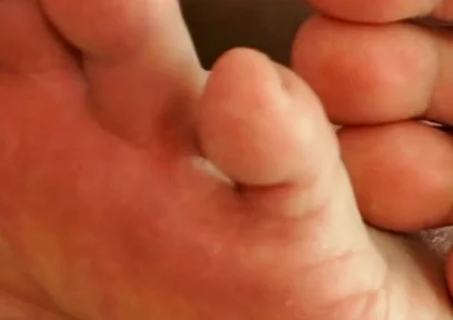 The Foot Master's Installation Protocol