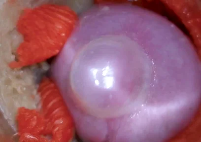 The Camera Inside the Deep Pussy Records a Huge Ejaculation with a Stuck Condom 4K