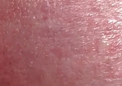 Sperm Close-up Front