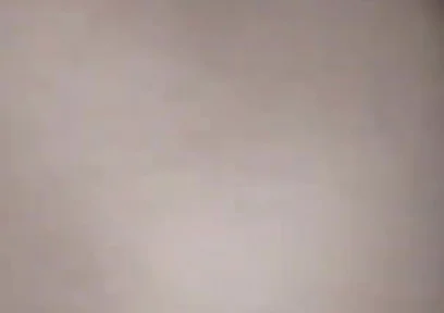 Destroying the Asshole on the Dick