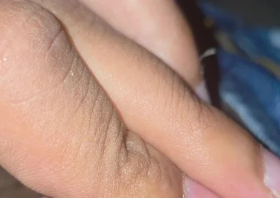 Closeup