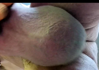 In Your Face Siliconed View.