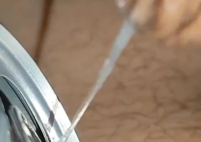 Immense Phimosis in the Can Makes You to the Extreme!