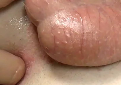 Stick Your Fingers in Casper's Butt
