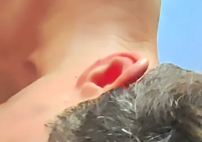 I Suck and Get a Facial