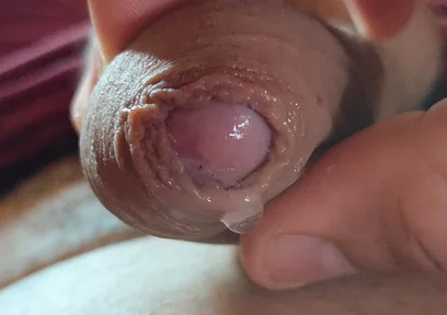 Close-up of Glans Ejaculating Intensely Before Cumming.
