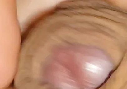 The World's Largest Foreskin Opening and Closing.