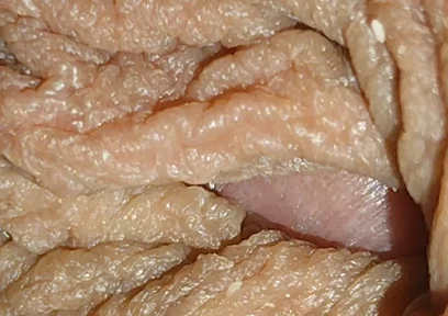 The World's Largest Foreskin Opening and Closing.