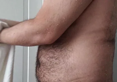 Drying off