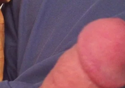 Surprise Dick