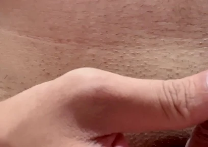 Papaya Seeds Inserted Into the Urethra