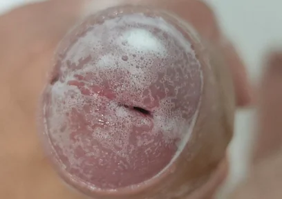 Extreme Burning Sensation Makes the Glans Foam with Arousal.