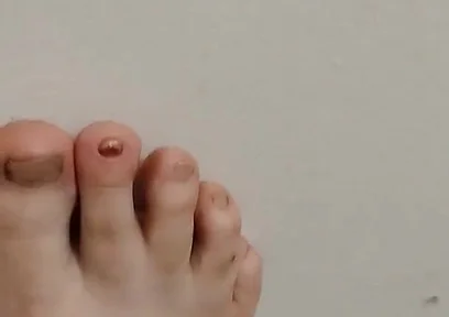 11-26-2025 Cute Little Toes