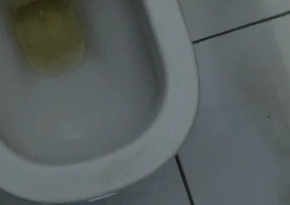 Homemade Method for Freezing the Penis